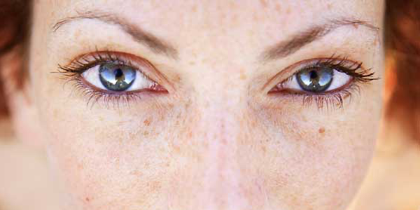 Eye Peel Treatments
