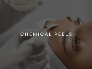 Chemical Skin Peel Treatments