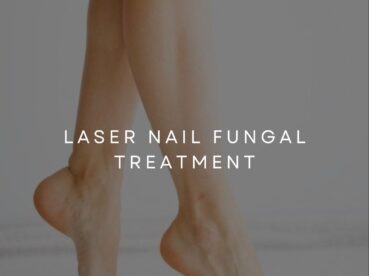 Laser Nail Fungal Treatment