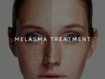 PROFESSIONAL DEPIGMENTATION