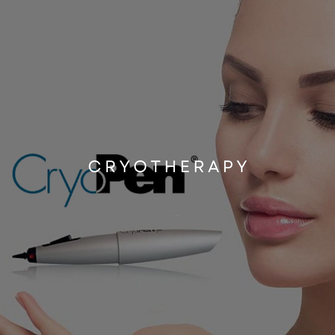 CryoPen Treatments in Liverpool