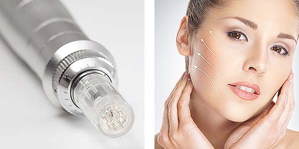 Mesotherapy treatment
