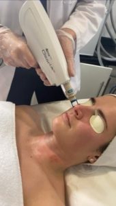 Laser Aesthetics: clearlift tone & tighten