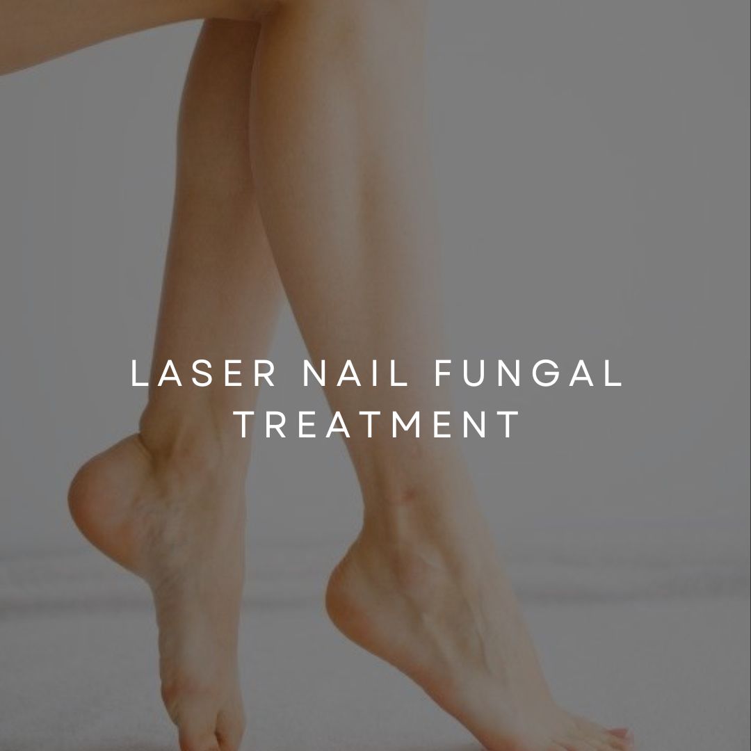 Laser Nail Fungal Treatment