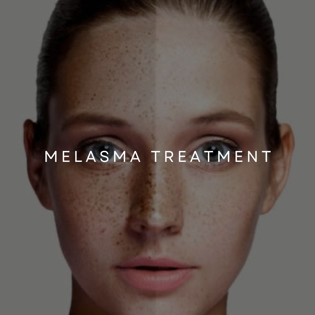 PROFESSIONAL DEPIGMENTATION